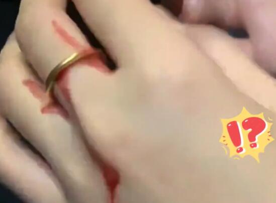 女子50元買倉鼠被咬花1000元 背后真相實(shí)在讓人驚愕
