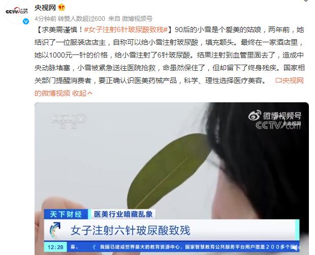 女子注射6針玻尿酸致殘 一針價(jià)格1000元