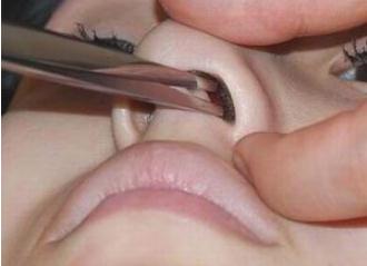 鼻毛變白是什么現(xiàn)象?